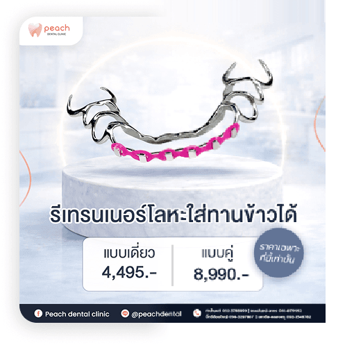 โปรโมชันรีเทนเนอร์โลหะใส่ทานข้าวได้ แบบเดี่ยว 4,495 บาท แบบคู่ 8,990 บาท
